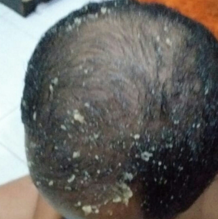 C'C Oil Penumbuh Rambut Alami - Mengatasi kebotakan serta Menyuburkan Rambut